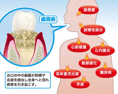 全身の健康に歯科が出来ること