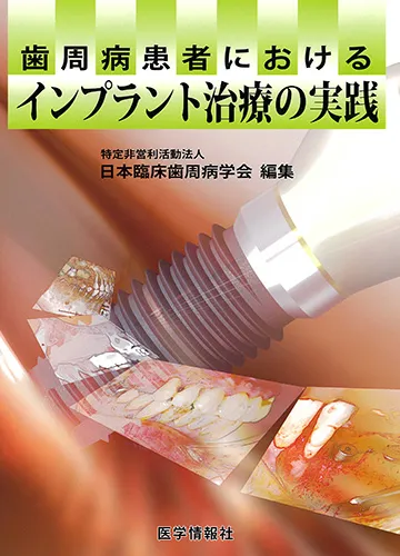 歯周病患者におけるインプラント治療の実践